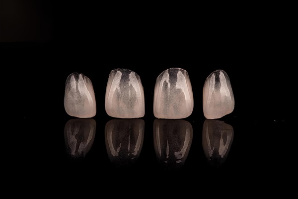 What Is A Dental Crown And When Do You Need One?