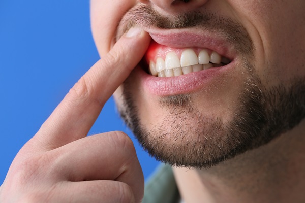 How Tooth Decay And Gum Disease Are Connected